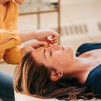 Patient resting while getting facial rejuvenation acupuncture treatment for skin tone and wrinkle prevention at Seneca Falls Acupuncture.