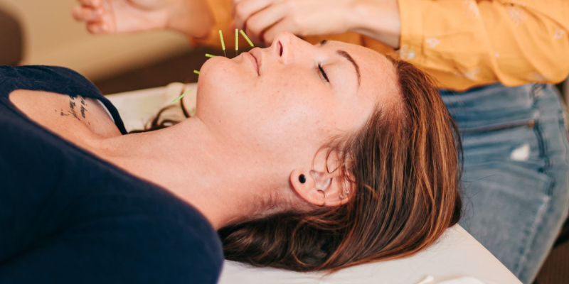 Patient resting during cosmetic acupuncture treatment at Seneca Falls Acupuncture.