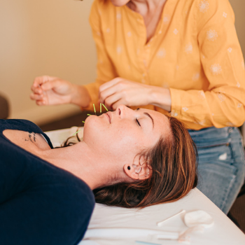 Patient resting during cosmetic acupuncture treatment at Seneca Falls Acupuncture.