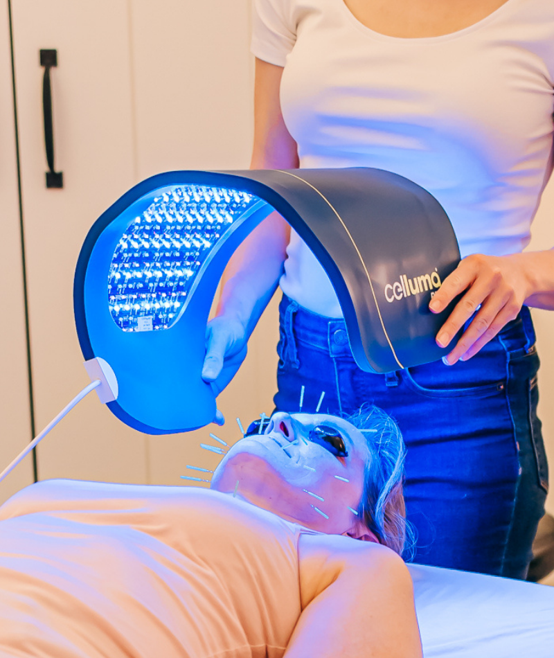 Celluma Light Therapy for Wrinkles, Acne and at Seneca Falls Acupuncture