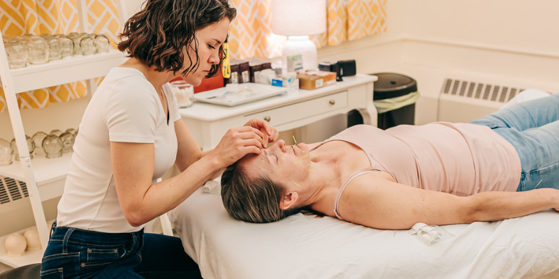 Patient relaxing during cosmetic acupuncture at Seneca Falls Acupuncture.