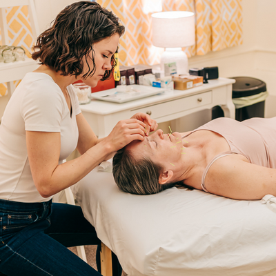 Patient napping during a cosmetic acupuncture treatment for wrinkles between the brows at Seneca Falls Acupuncture.