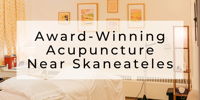 Award-winning acupuncture near Skaneateles, NY